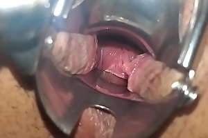 Speculum about pussy rearrange in all directions